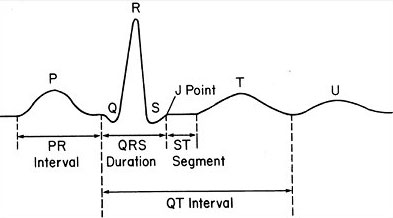 Basics of ECG